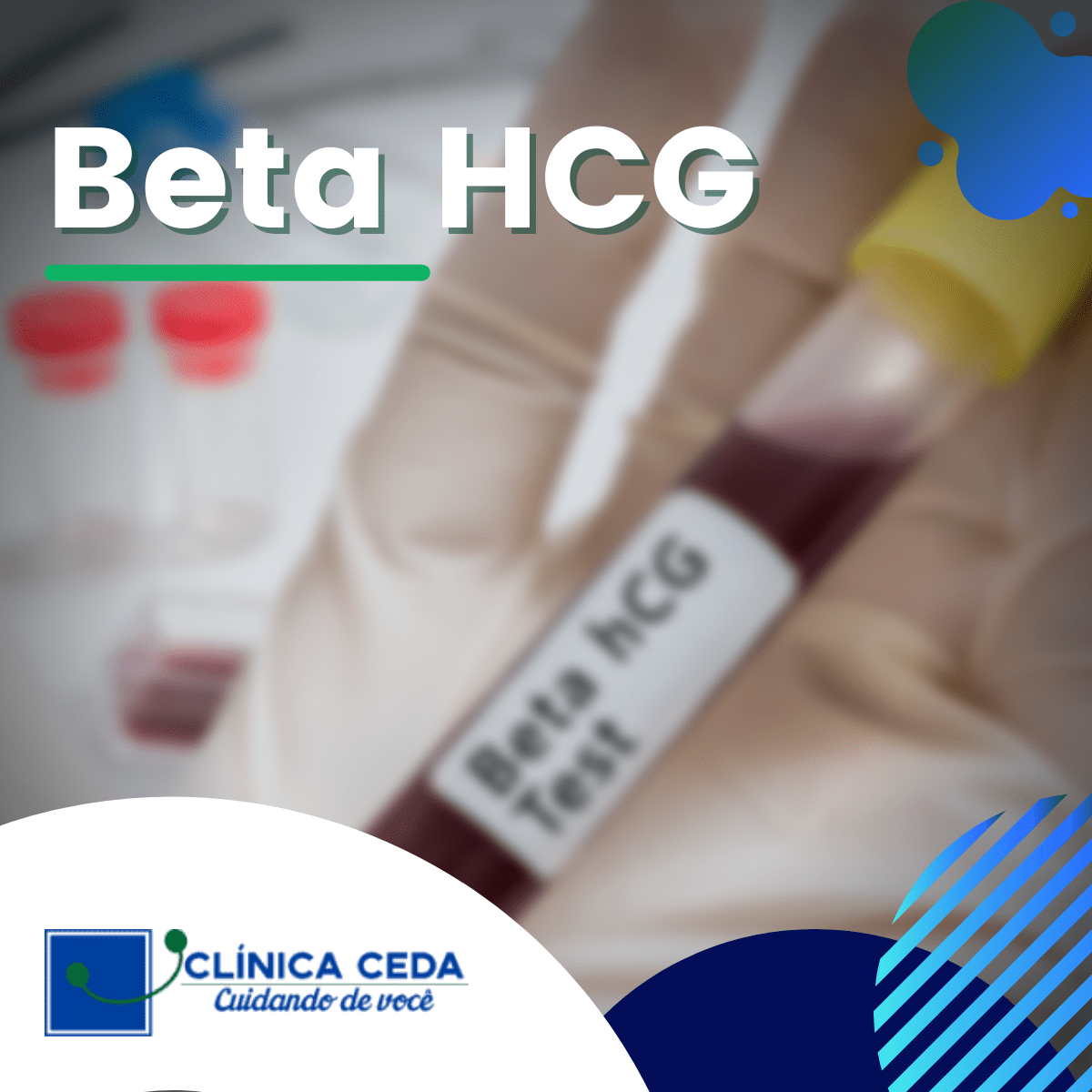 Exame Beta HCG em Natal e Parnamirim - Clínica CEDA