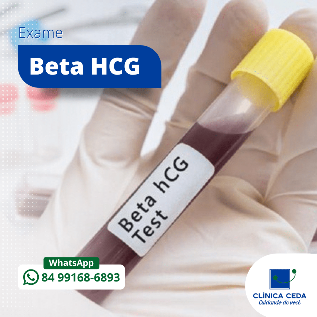 Exame Beta HCG