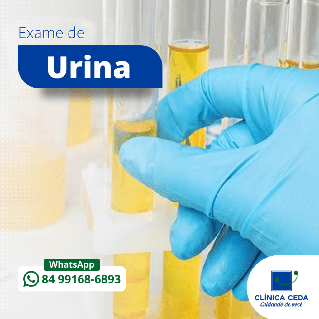 Exame de Urina - Por favor me ajudem!!!!